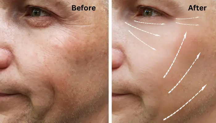 What is the Difference Between Photo Editing and Retouching Image showing photo Retouching before and after